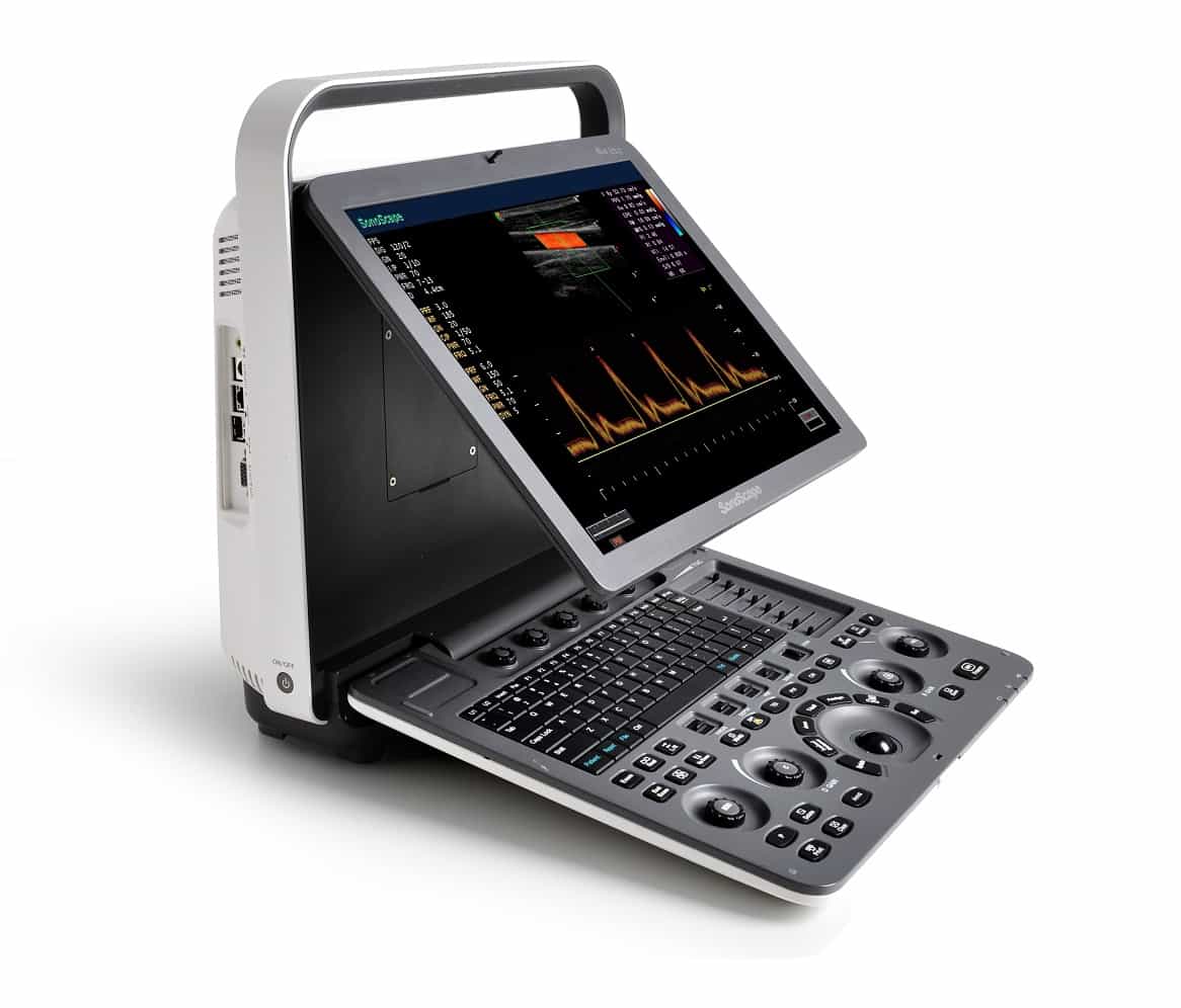 S8 EXP Portable Ultrasound System