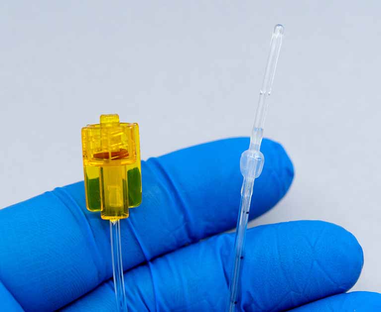 Single Sensor Bladder Urodynamics Catheter